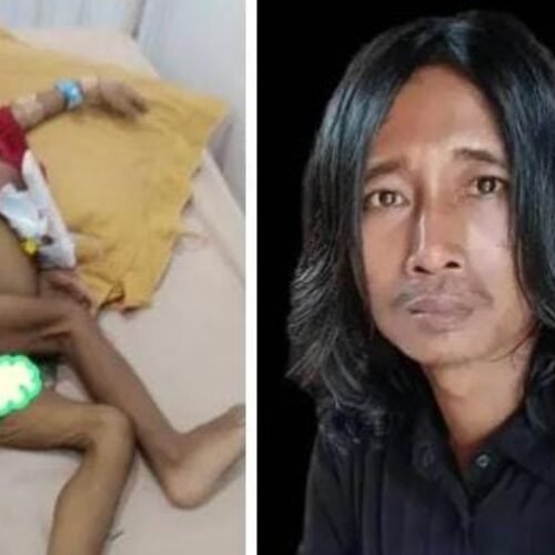 Warga Bayas Jaya Alami Kurang Gizi Butuh Perhatian Pemerintah, Mendapat Sorotan Ketua JWI DPW Lampung 