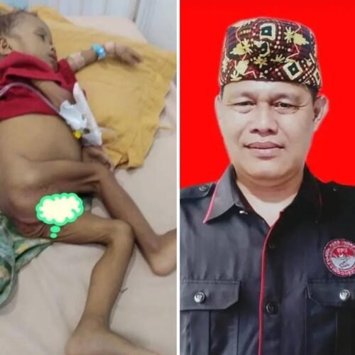 Sufiyawan Ketua Setwil FPII Provinsi Lampung Angkat Bicara Terkait Warga Bayas Jaya Kurang Gizi Stunting 