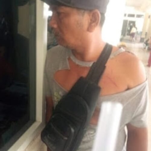 Ketersediaan Dokter Forensik di RSUD Sibolga Dinilai Mendesak, Pelayanan Masyarakat Jadi Sorotan
